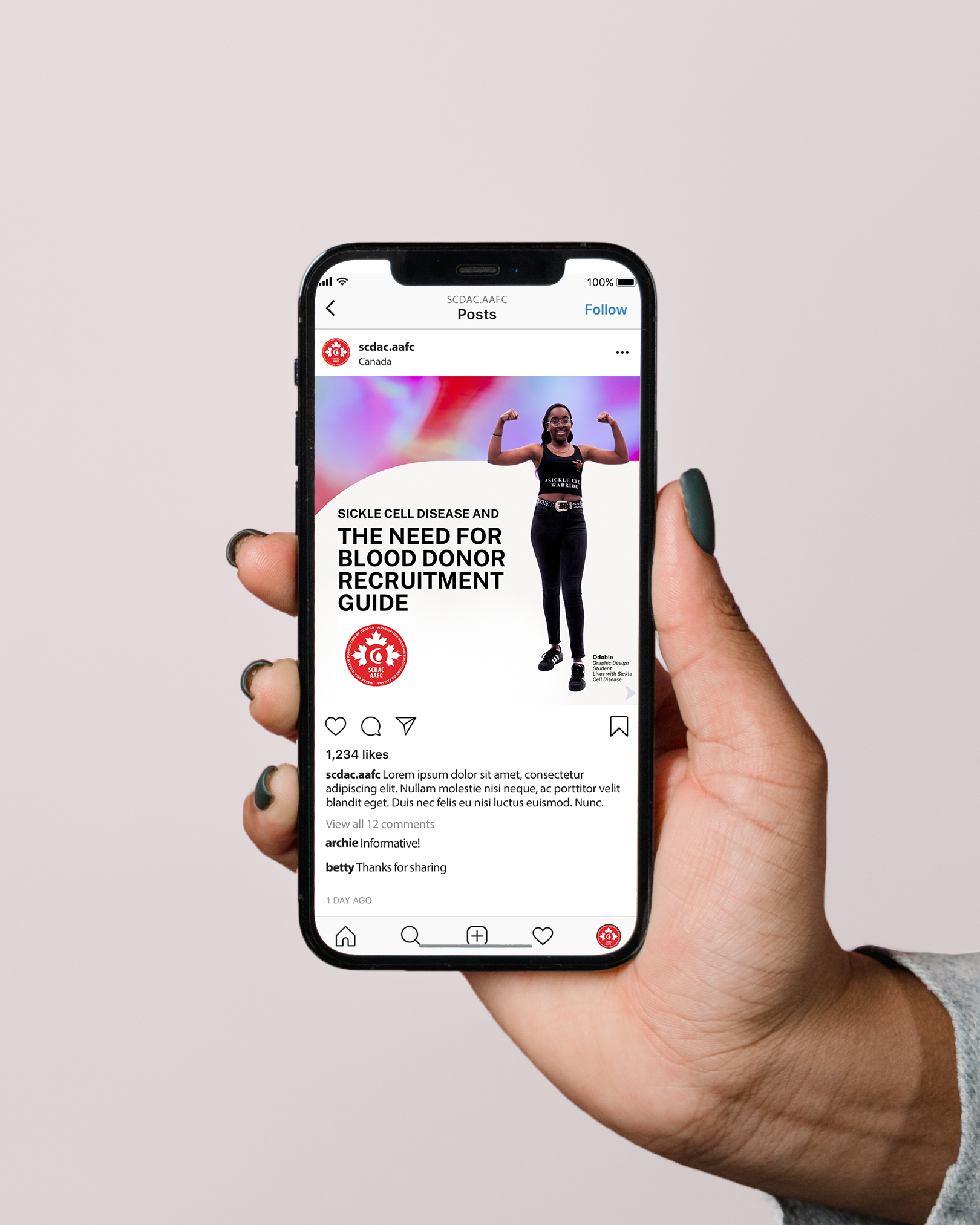 Mobile phone displaying carousel about Sickle Cell Disease